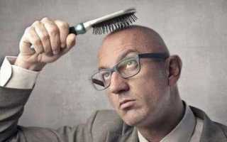 Почему мужчины лысеют: причины потери волос